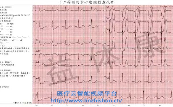 遠(yuǎn)程心電會(huì)診系統(tǒng)